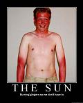 gingersunburn